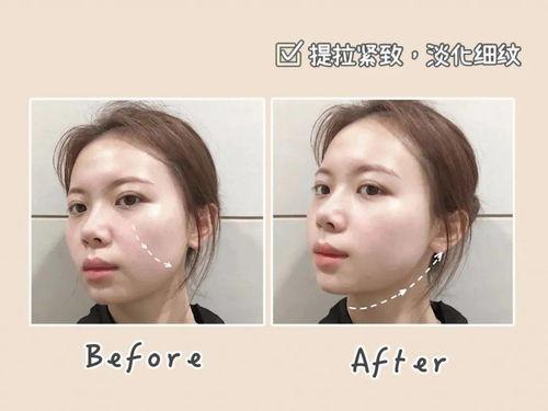 网红面部项目,打造完美容颜的秘密武器